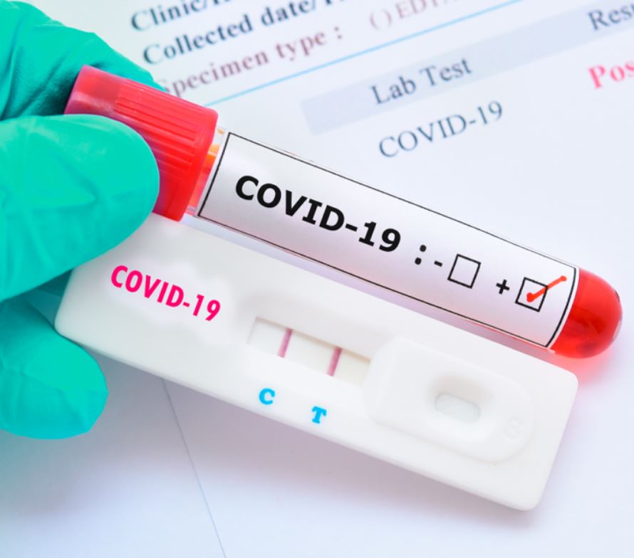 Novos casos de covid são confirmados nas Olimpíadas e situação preocupa