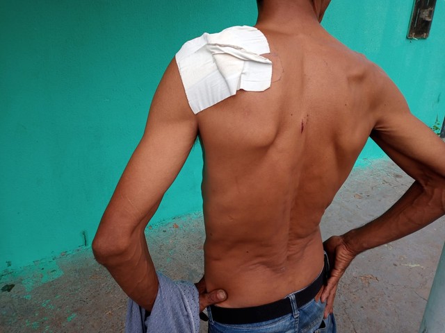 Briga por ‘tossida’ em carro de aplicativo termina com um baleado; vídeo