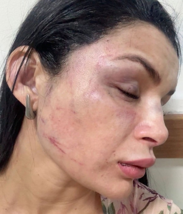 Polícia prende suspeito de agredir passageira de app no Petrópolis