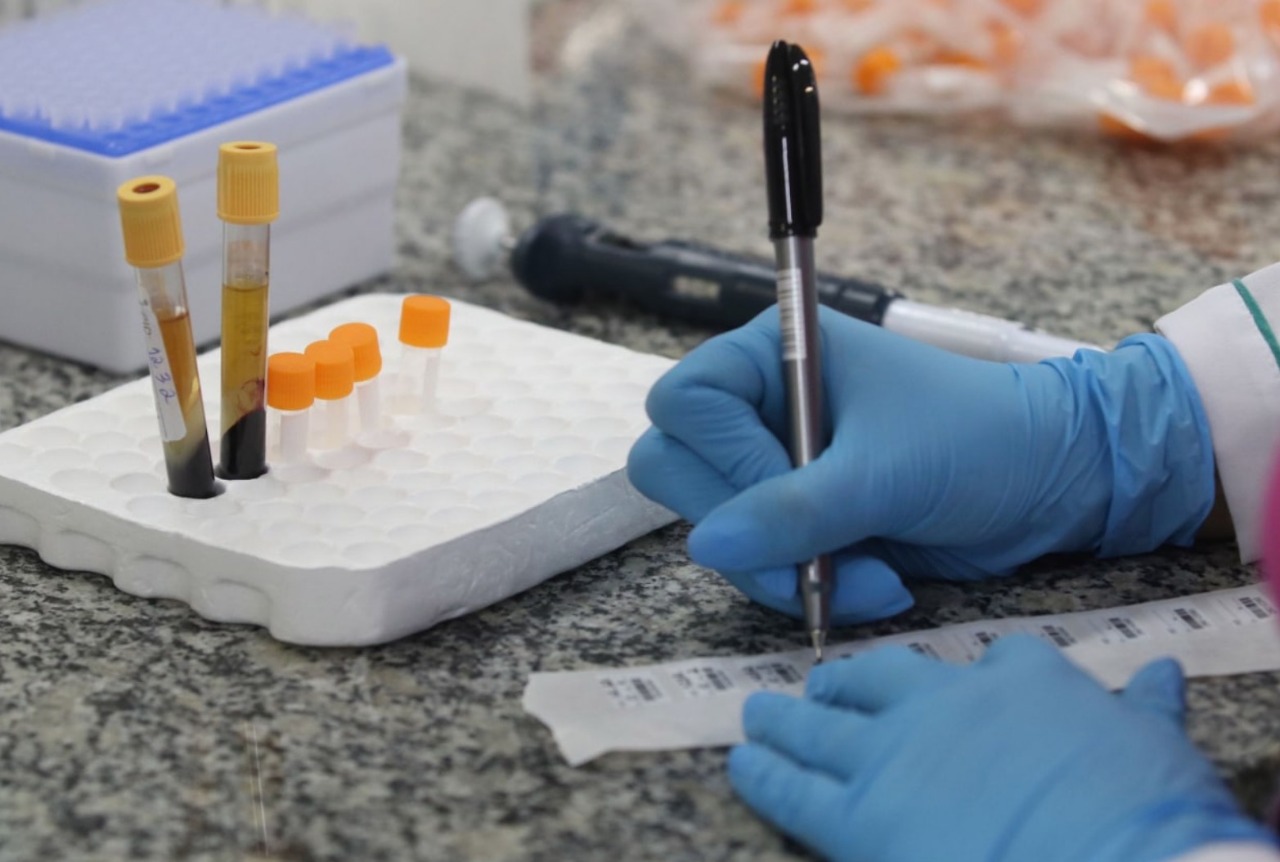 Amazonas confirma 10 mortes e 575 novos casos de Covid-19, em 24h