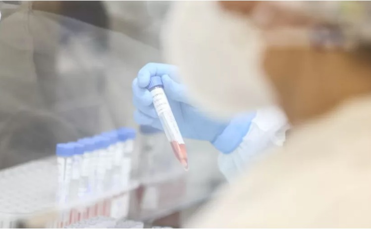 Paraná confirma primeiro caso da variante indiana