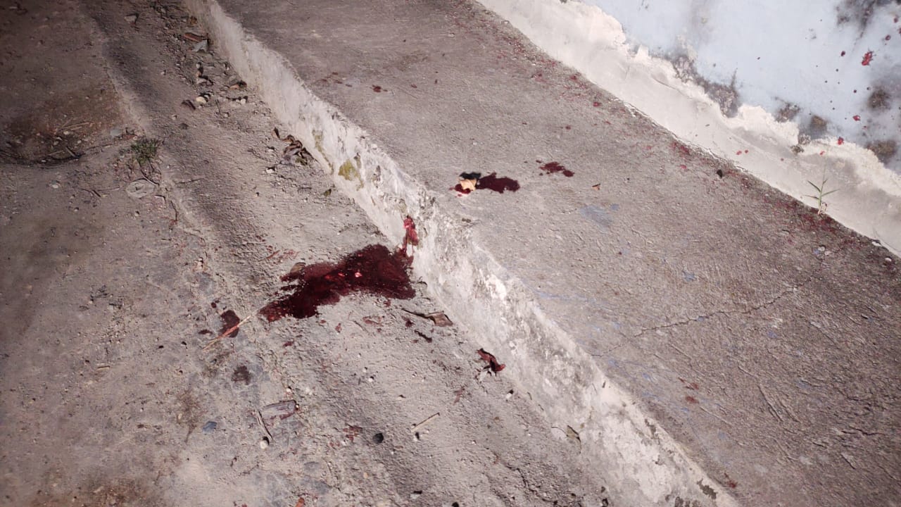 Homem leva tiro na boca durante assalto em Manaus