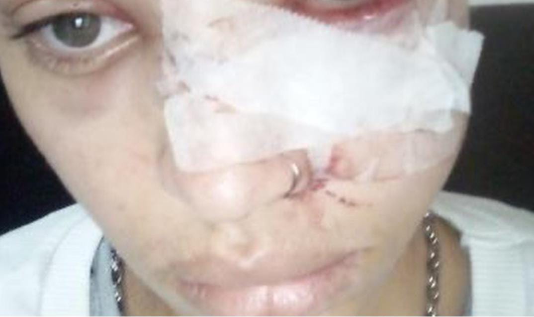 Padrasto tentar matar enteado trans a facadas