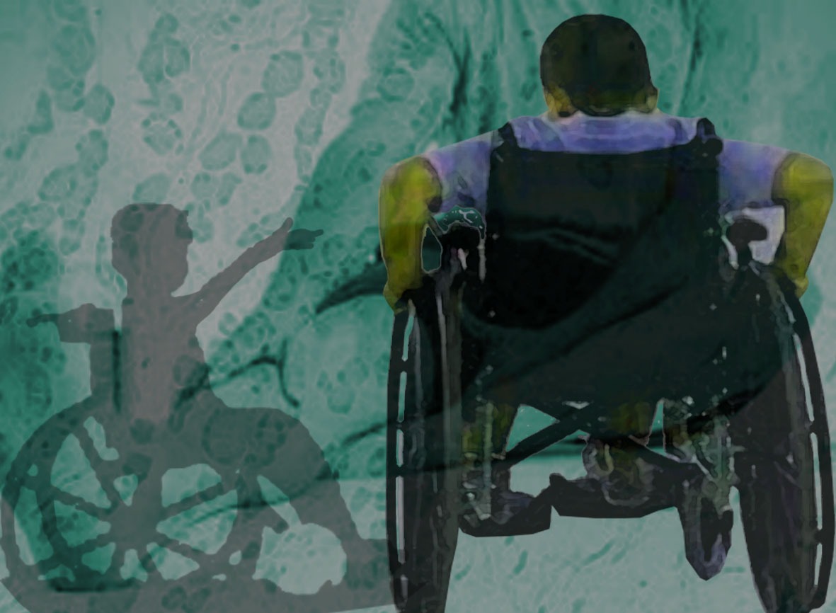 Conheça os sintomas de distrofia muscular em crianças