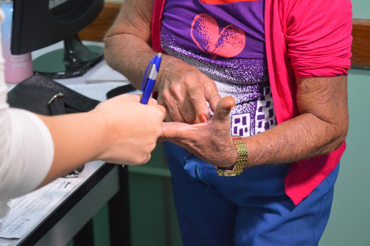 Especialista alerta para prevenção ao câncer de pele no verão amazônico