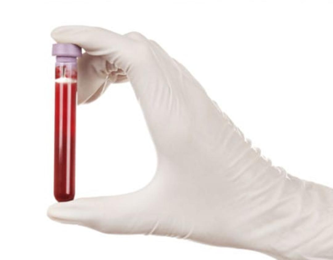 Senado proíbe discriminação a doadores de sangue homossexuais