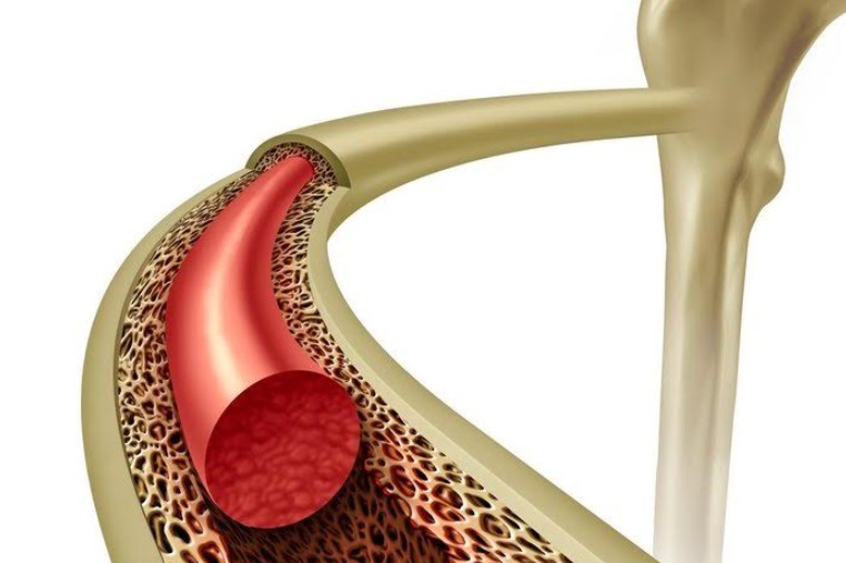 Você sabe o que é medula óssea e para que ela serve?