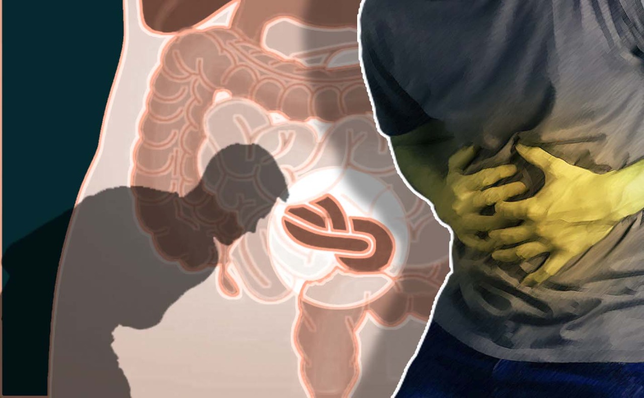 Obstrução intestinal: um problema de saúde que requer atenção redobrada