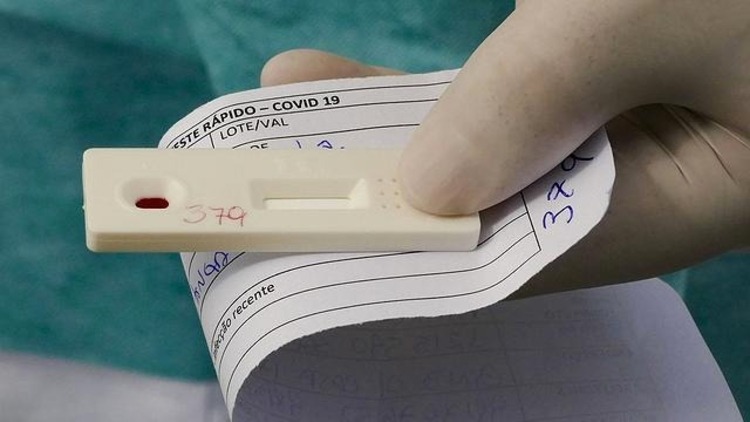 Anvisa deve aprovar autoteste de Covid nesta quarta