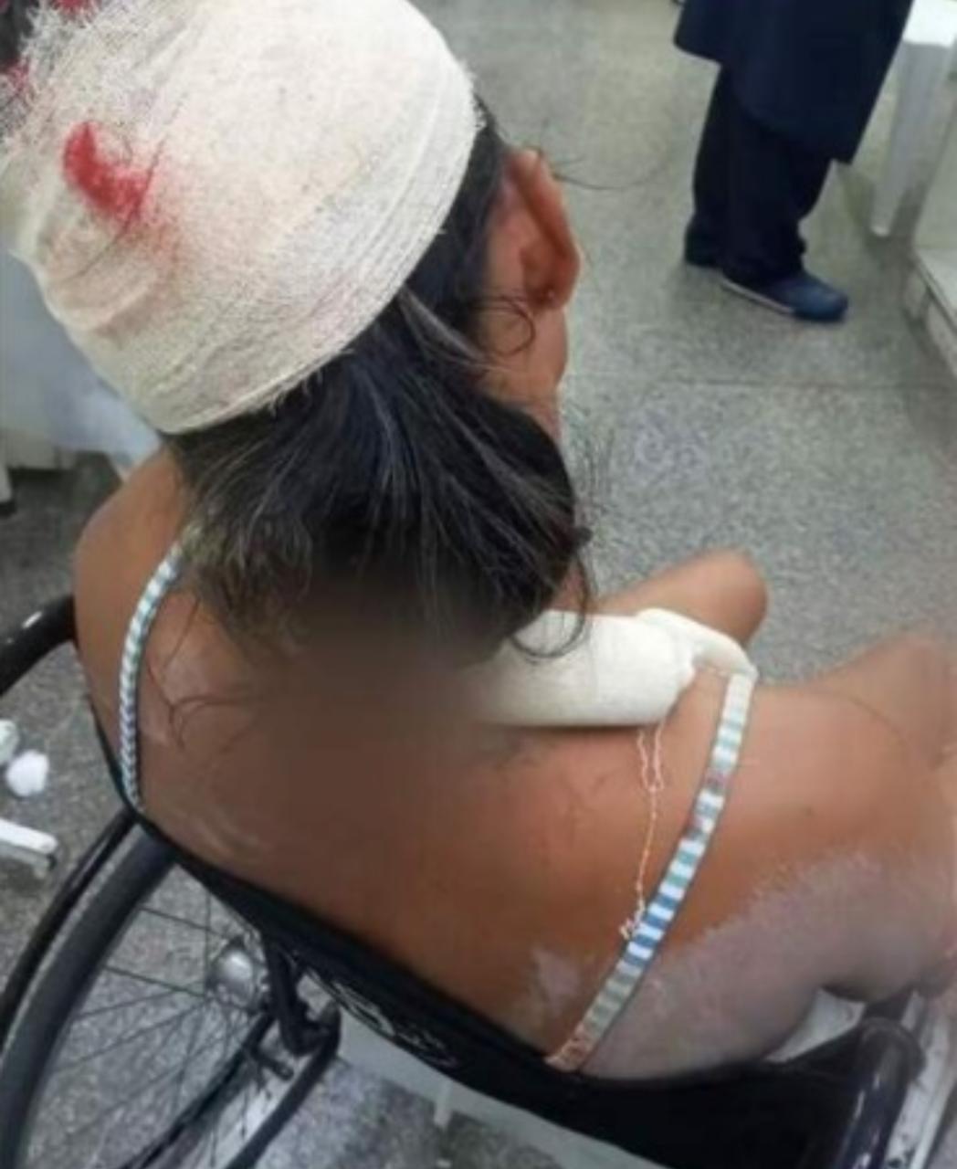 Sem aceitar separação, homem agride e quebra ossos de ex-mulher em Manaus