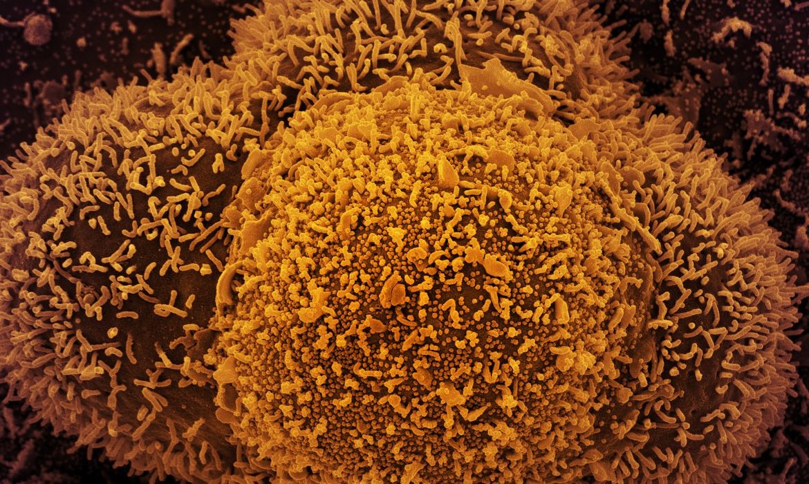 SP registra terceiro caso de subvariante mais infeciosa da Ômicron 