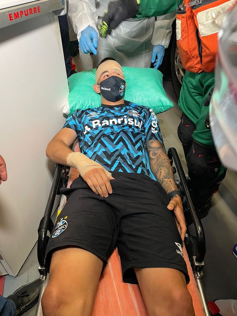 Ônibus do Grêmio é apedrejado antes de clássico e atleta fica ferido