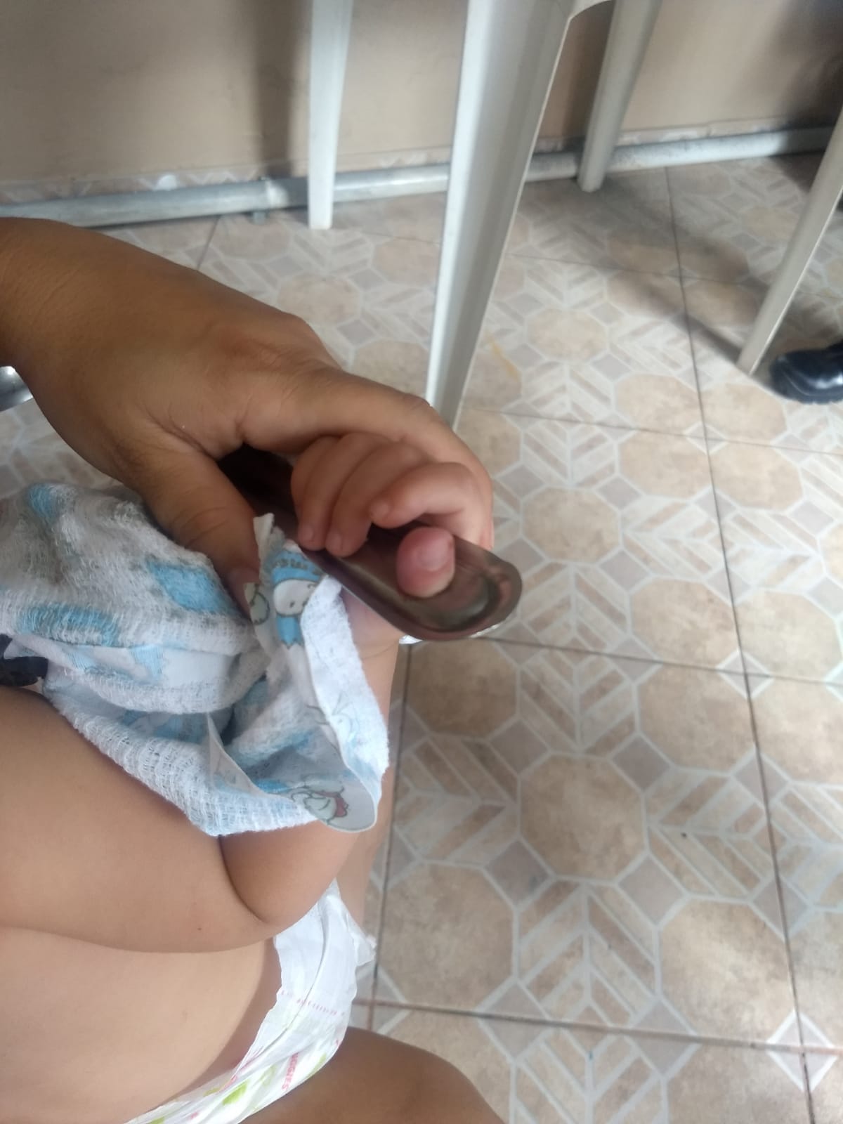 Bebê de 1 ano tem dedo preso em concha e Bombeiros são acionados em Manaus