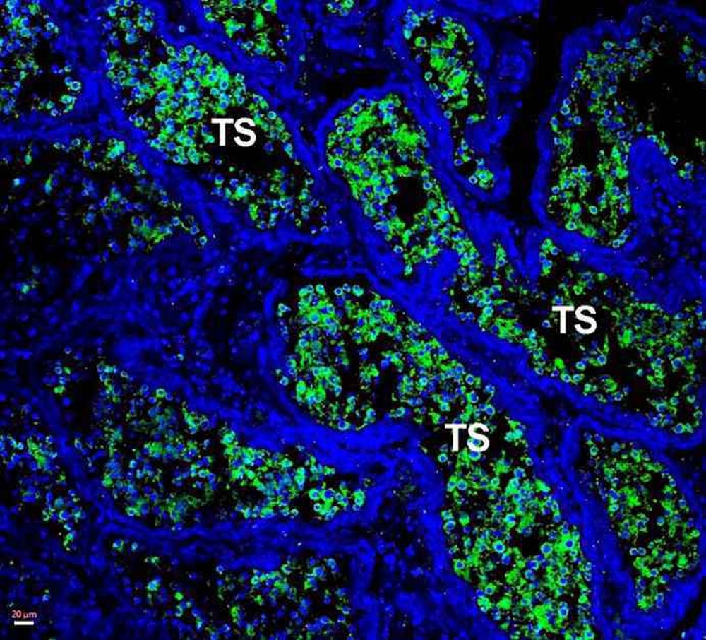 Pesquisa aponta que testículos podem se tornar 'santuário da Covid'