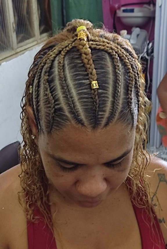 Anvisa proíbe venda de pomada para cabelos que causou cegueira em mulher