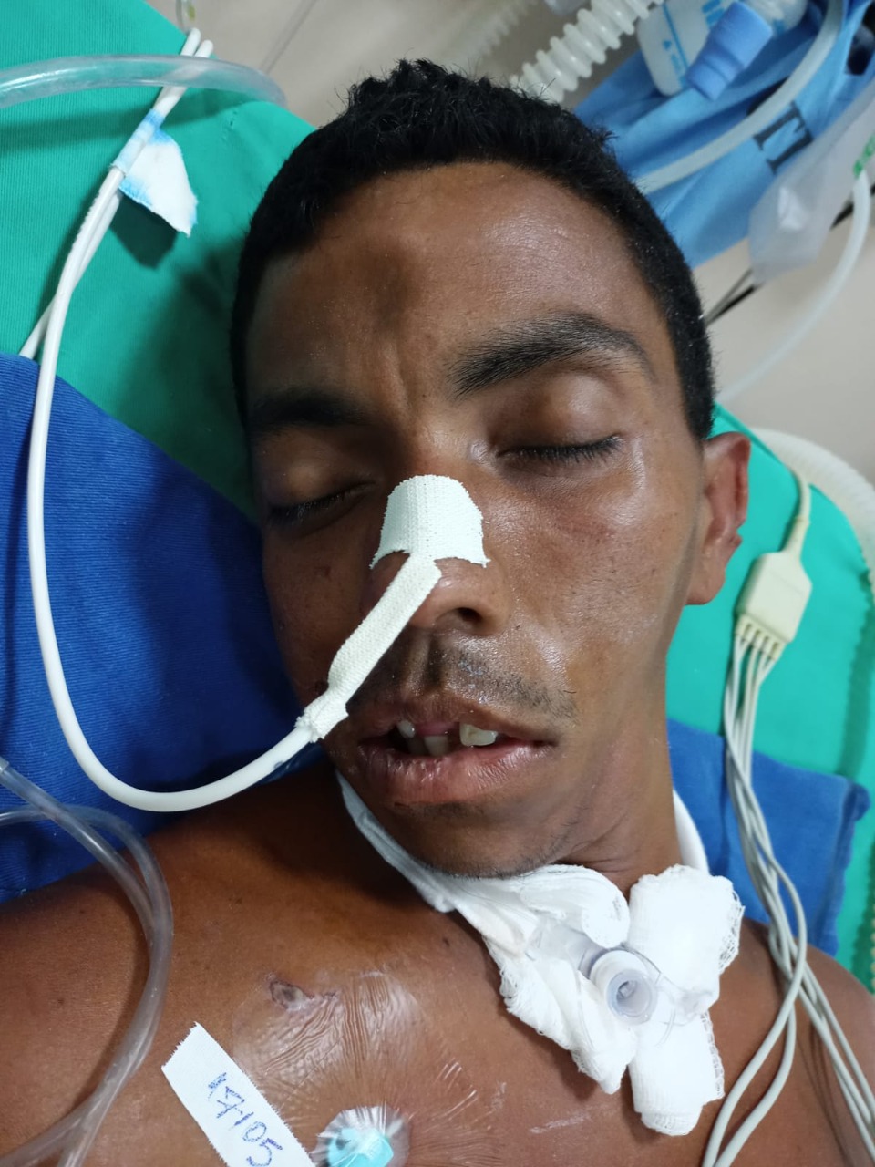 Hospital procura família de paciente que foi atropelado em Manaus