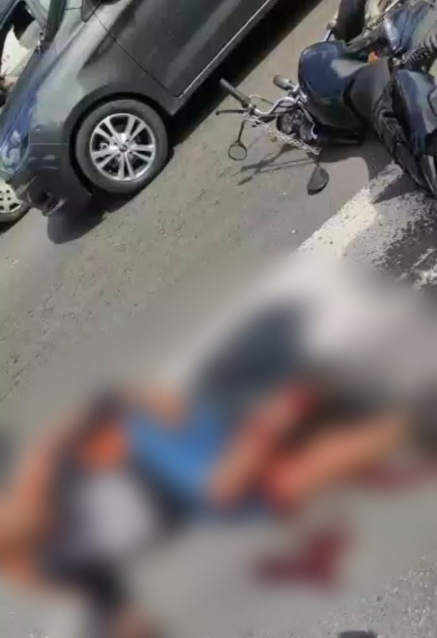 Motociclista tem perna quebrada ao sofrer grave acidente em Manaus; vídeo