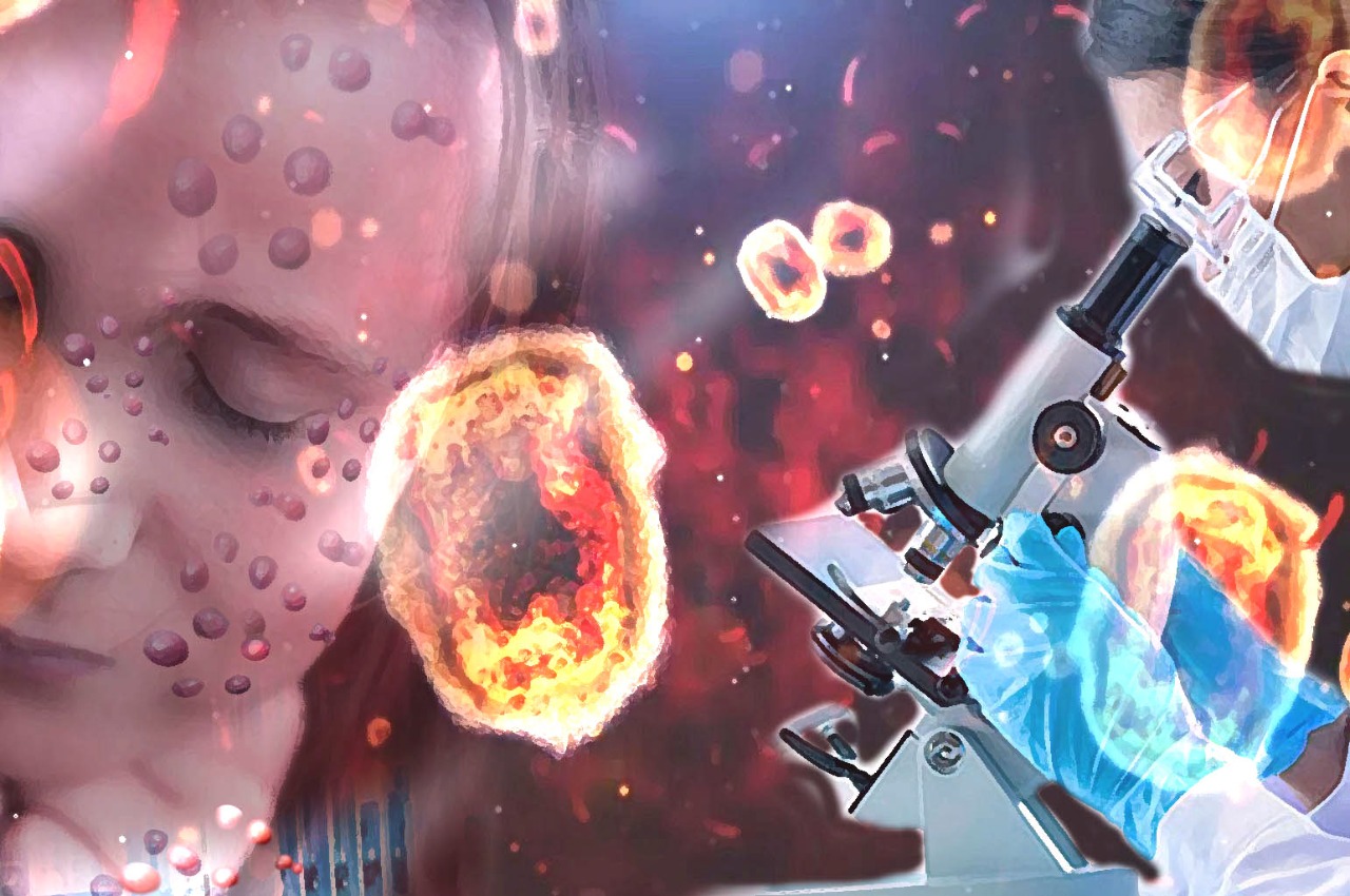 Fiocruz conclui sequenciamento genético do vírus da varíola dos macacos