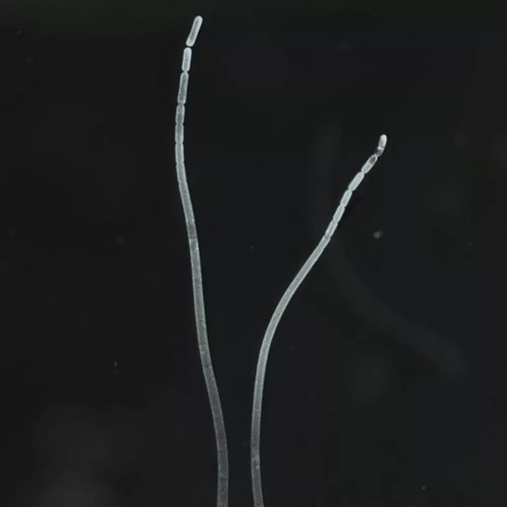 Cientistas descobrem bactéria gigante e visível a olho nu 