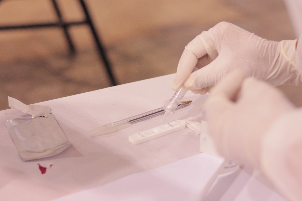 Semsa amplia postos de testagem após subida de casos de covid em Manaus