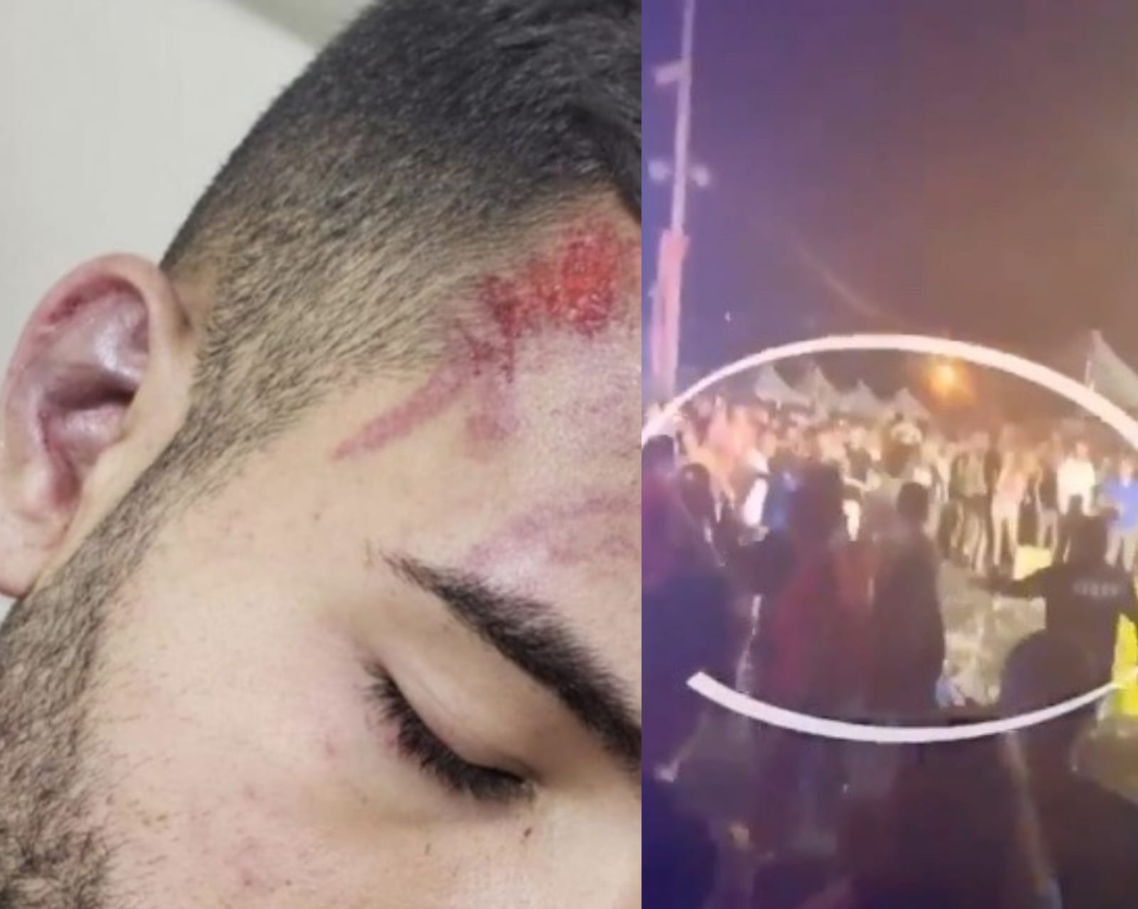 Grupo que espancou estudante de medicina em bloco de carnaval vai a júri popular em Manaus