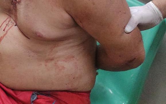 Homem 'ouve vozes' e dá facadas na esposa e na sogra em Manaus