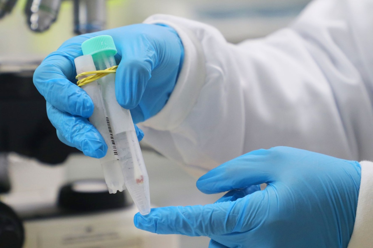 Amazonas registra 124 novos casos de Covid em 24 horas