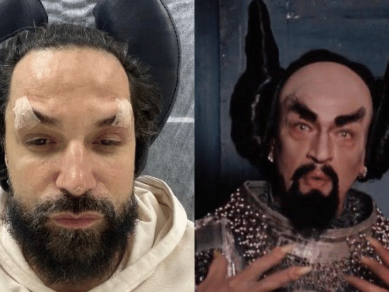 Latino desabafa após ser comparado a Diabo por rejuvenescimento facial