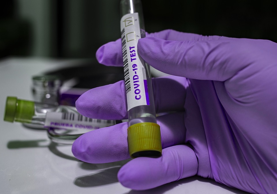 Covid-19: Brasil registra 28 mil casos e 211 mortes em 24 horas