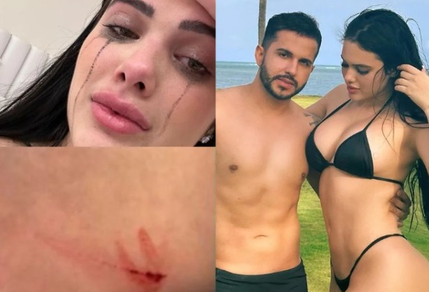Emily Garcia acusa irmão de Lucas Guimarães de agressão e expõe hematomas