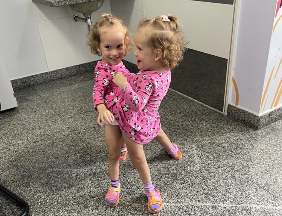 Gêmeas siamesas se reveem e dão as mãos pela 1ª vez após separação