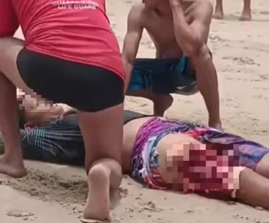 Banhista é atacado por tubarão no litoral de Pernambuco