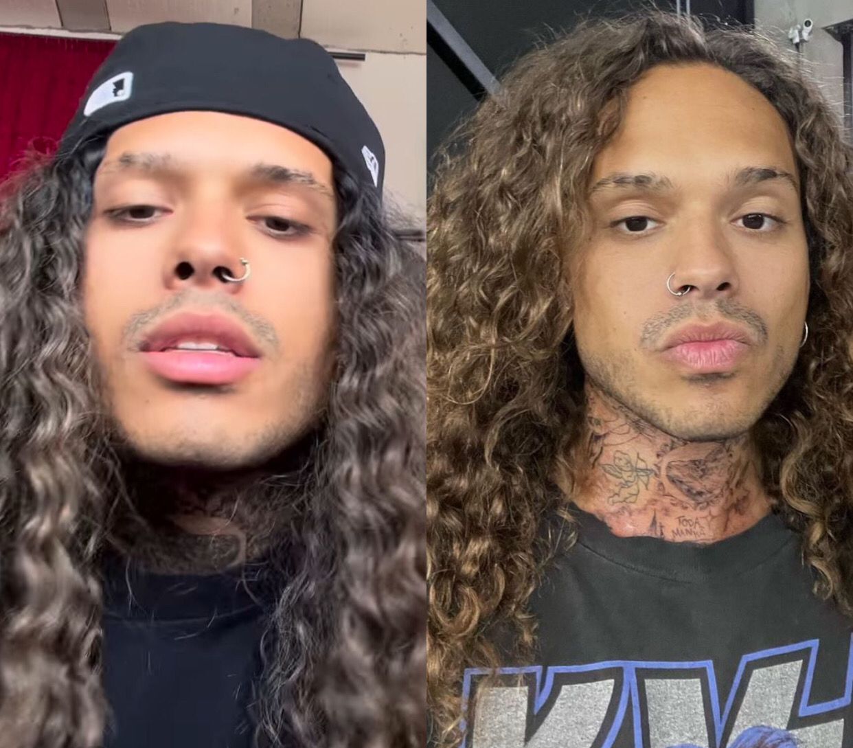 Vitão está careca e tem usado peruca em shows, revela colunista