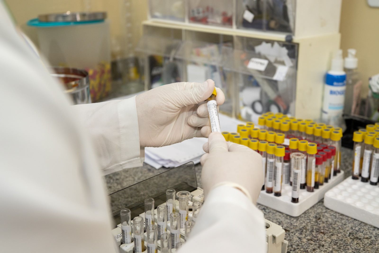 Manaus participa de projeto de prevenção a adoecimento e morte por Aids