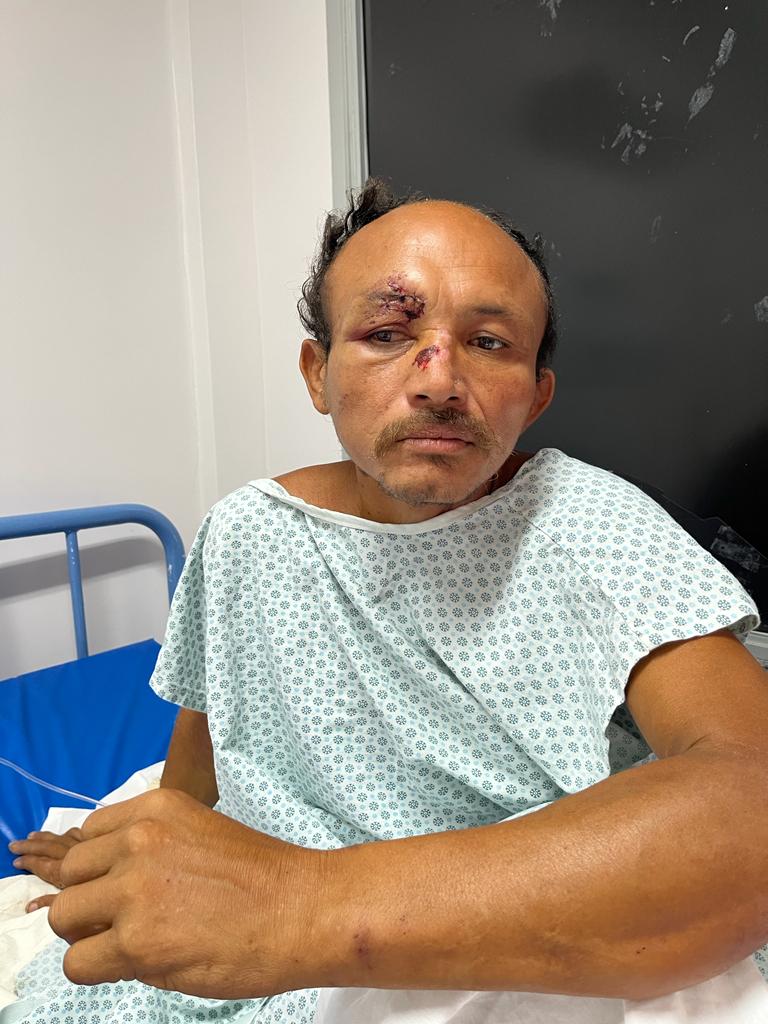 Hospital Platão Araújo procura família de homem atropelado em Manaus