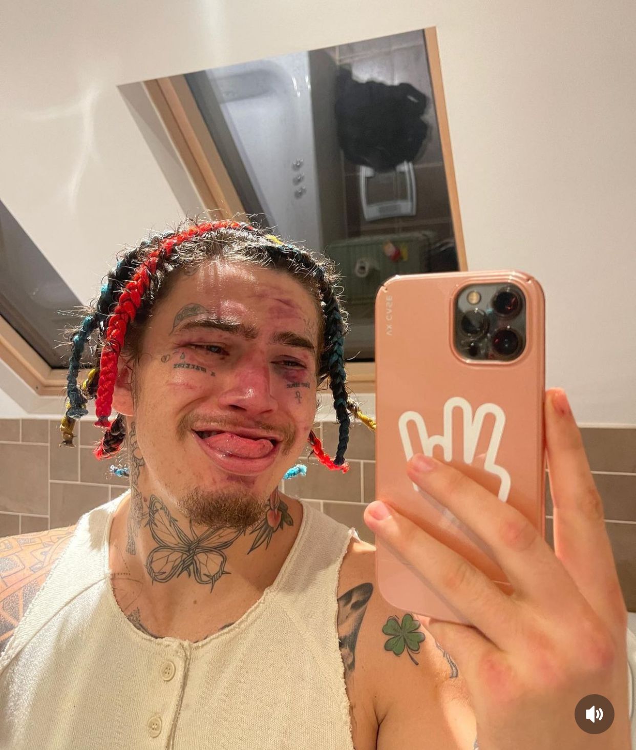 Whindersson mostra rosto machucado após luta contra King Kenny 