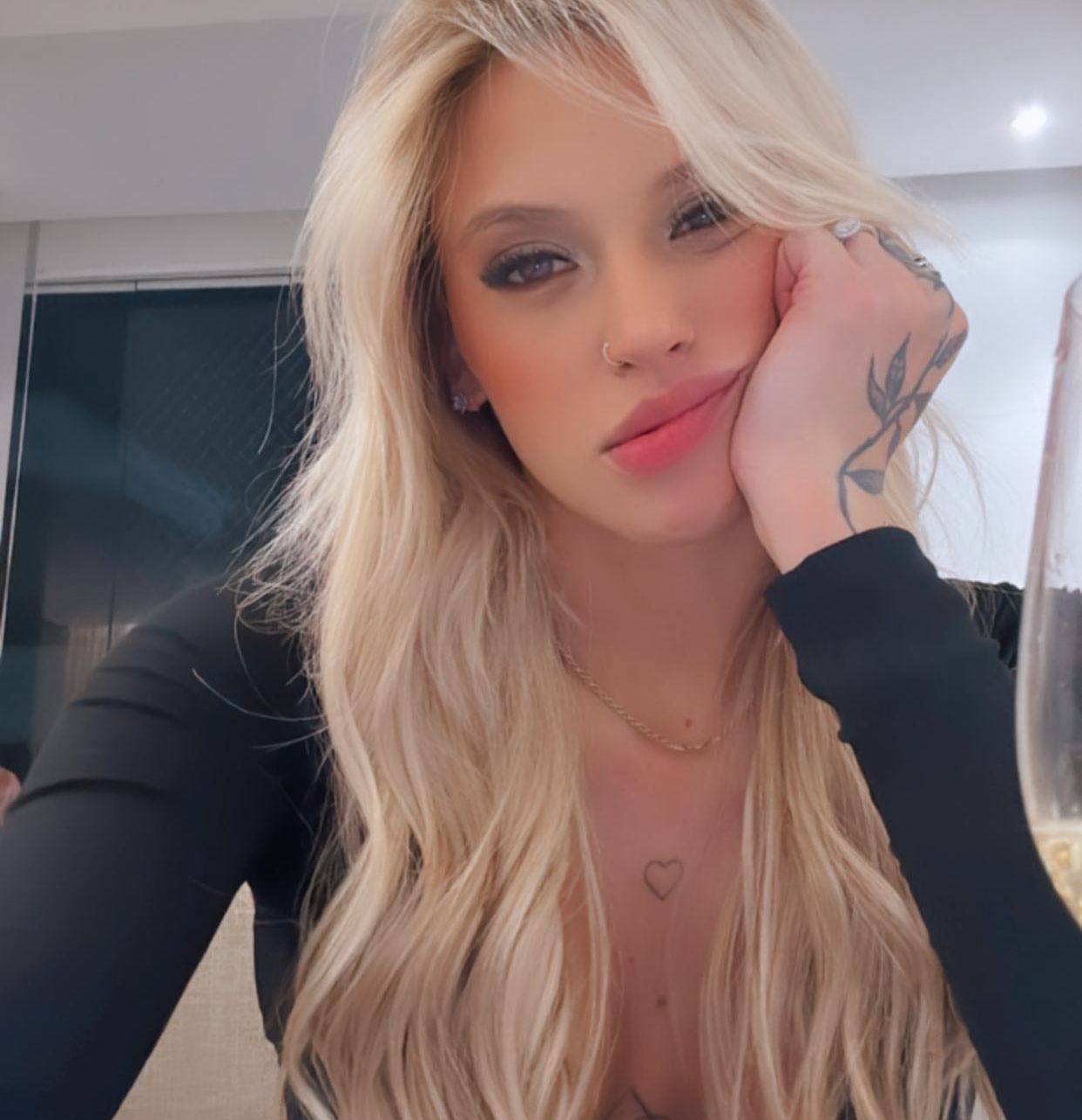 Namorada de Éder Militão revela que quase morreu após colocar silicone 