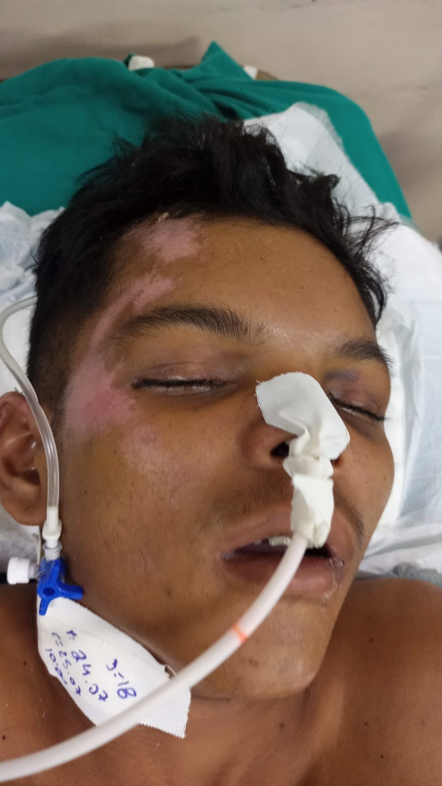 Hospital procura familiares de paciente internado por agressão em Manaus