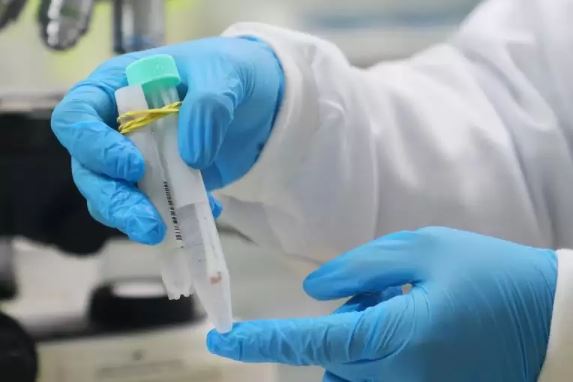 Amazonas completa seis meses sem registrar casos confirmados de Mpox