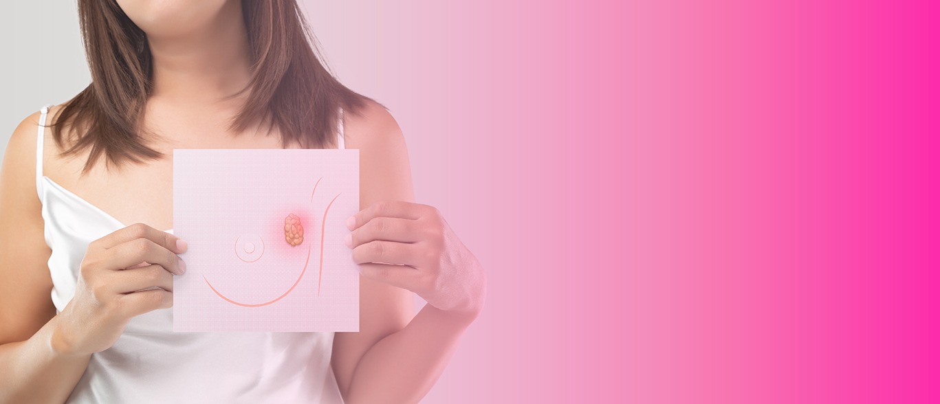 Poluição aumenta risco de câncer de mama, aponta estudo