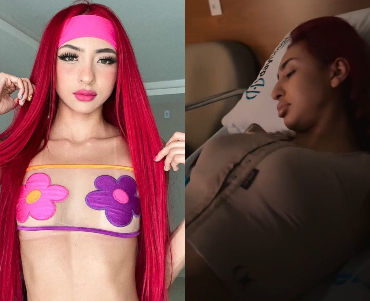 Ruivinha de Marte coloca silicone e mostra antes e depois