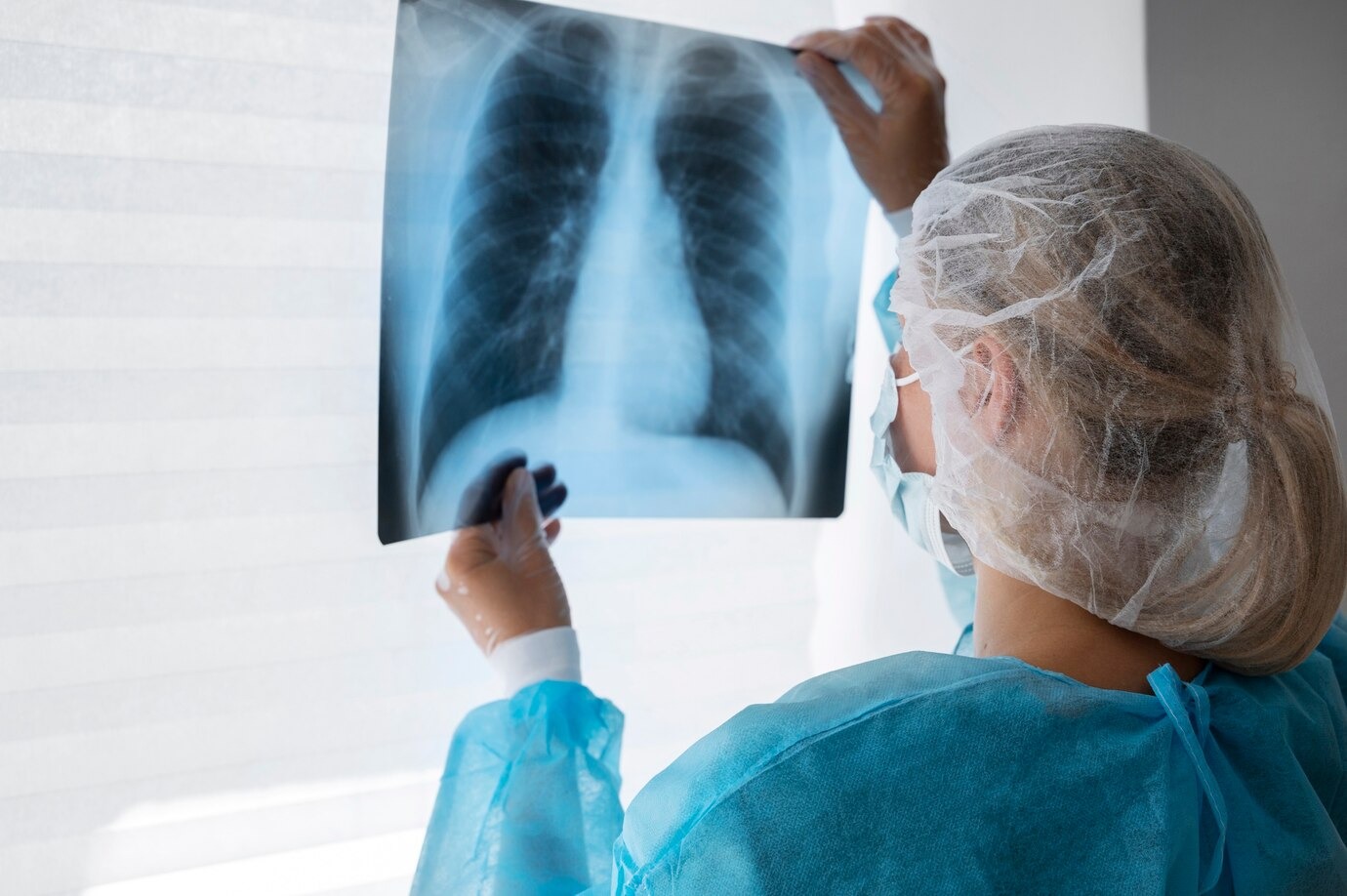 Diagnóstico precoce favorece tratamento e cura da tuberculose