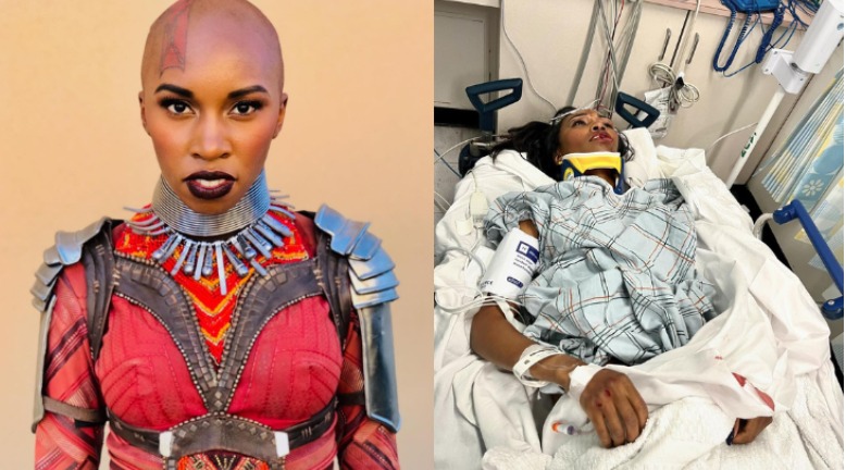 Atriz de Pantera Negra sofre ferimentos graves após ser atropelada