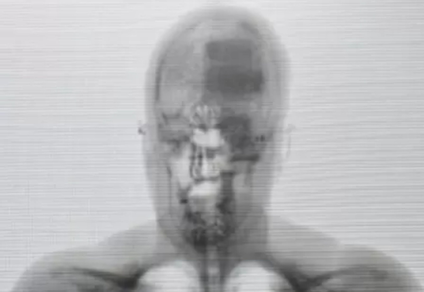 Mulher tenta entrar em presídio com 4 celulares escondidos no cabelo