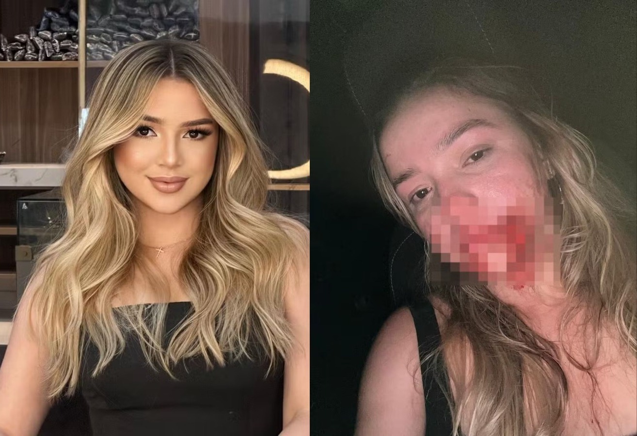 Modelo leva soco de síndico após reclamar de cheiro de gás em condomínio