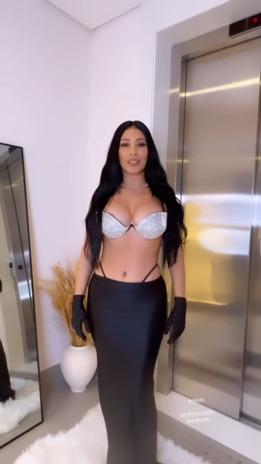 Simaria revela que fez lipoaspiração e mostra resultado