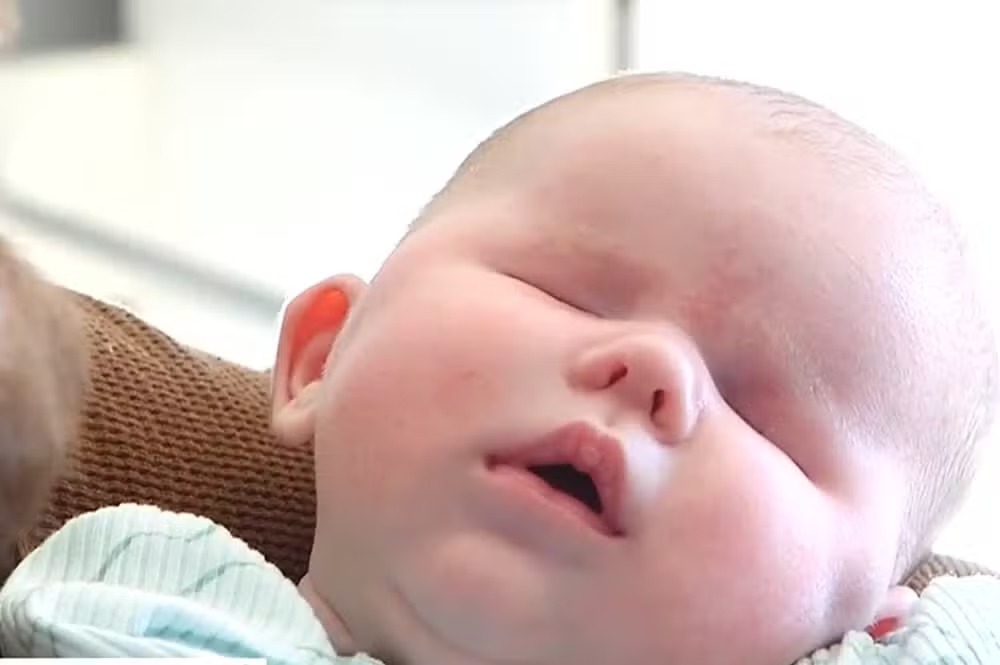 Em condição rara, bebê nasce sem os olhos