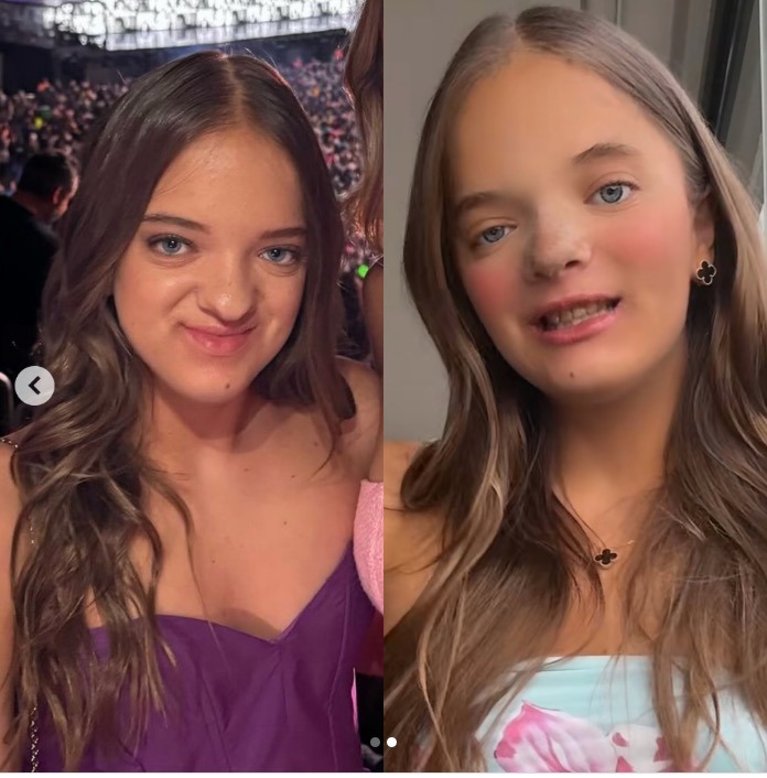 Rafaella Justus exibe nariz após cirurgia plástica; Veja antes e depois 