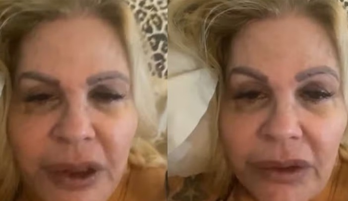 Abatida, Monique Evans diz que não consegue comer após contrair dengue