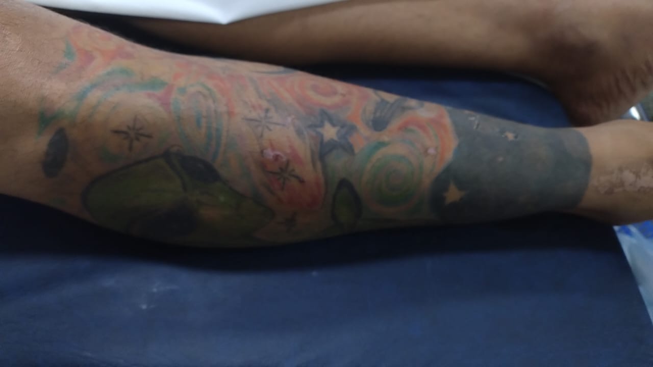 Hospital João Lúcio procura familiares de paciente internado por agressão